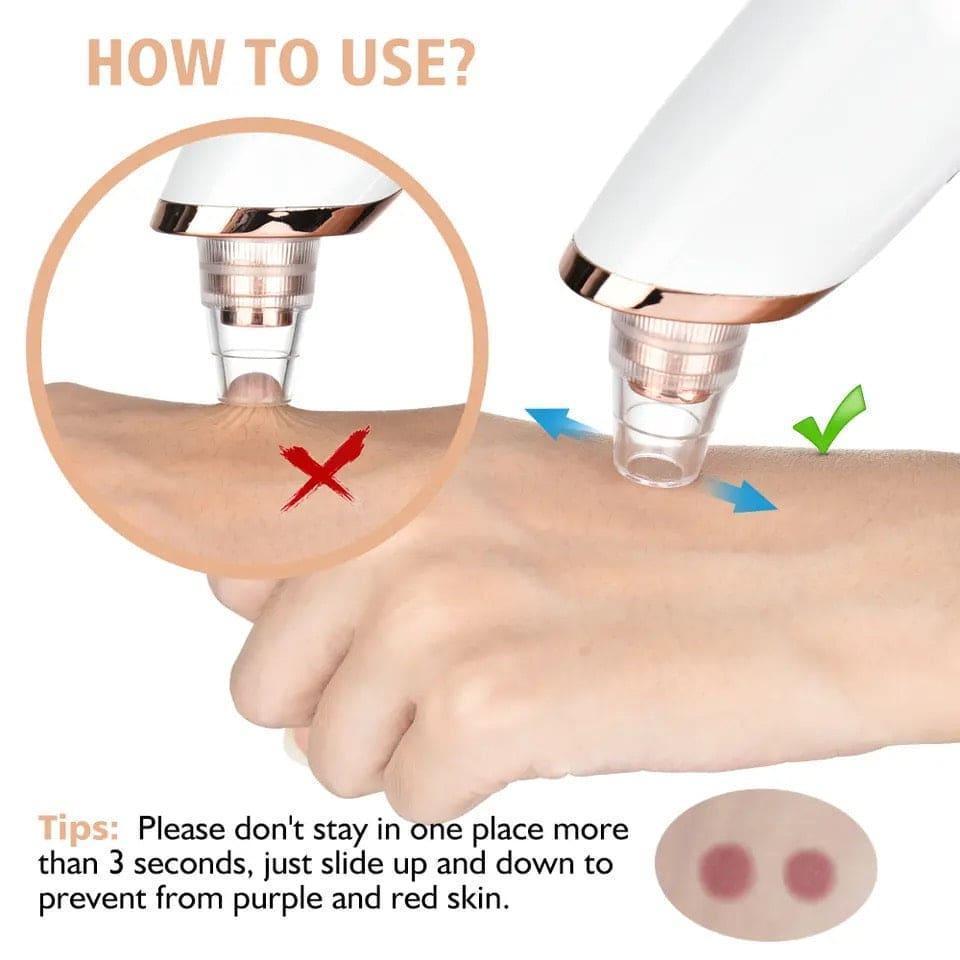 Blackhead Remover Nose Pore Cleaner White Device