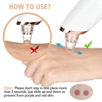 Blackhead Remover Nose Pore Cleaner White Device