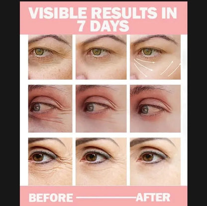 Premium Eye Cream for Dark Circles & Puffiness 30ml